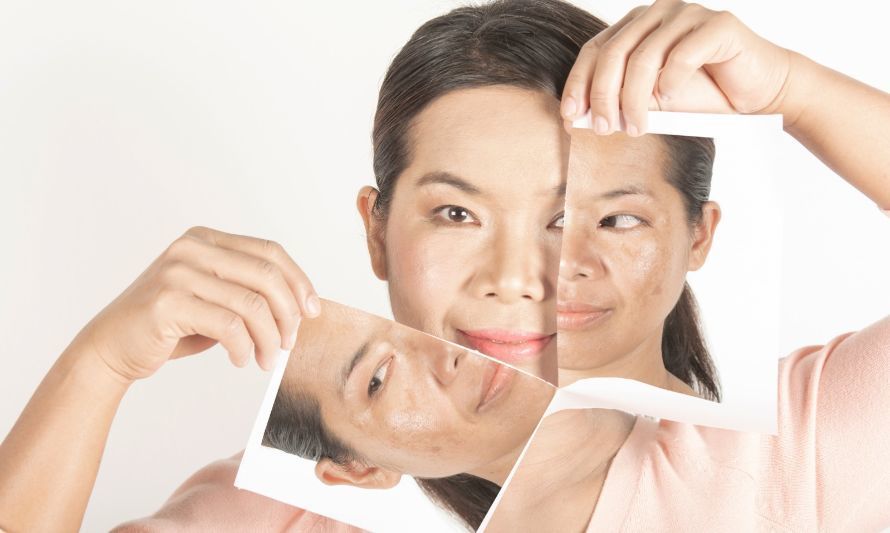 Cómo combatir las manchas en la piel: una rutina de cuidado facial efectiva